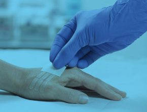 Wound Closure Product