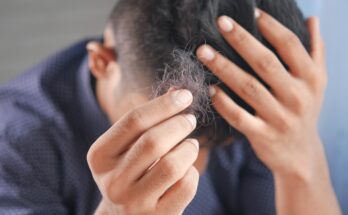 Best Hair Loss Tips You Will Read This Year