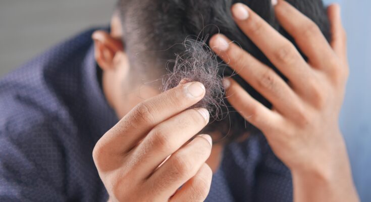 Best Hair Loss Tips You Will Read This Year